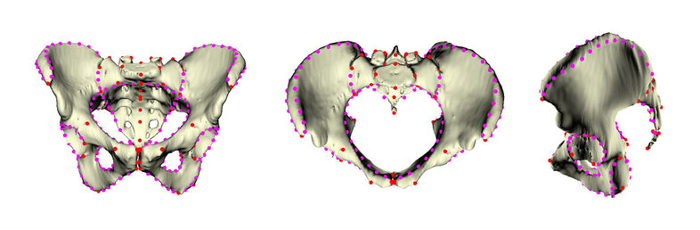 Weibliche Becken werden für die Analysen vermessen. Das 3D Modell des Beckens stammt von einem CT-Scan einer Patientin.